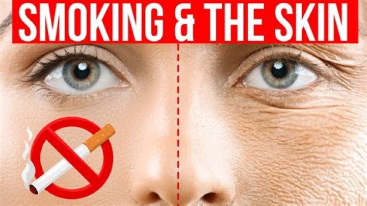 Are smokers happier than non-smokers?