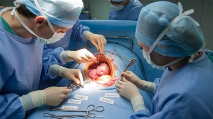 Are you awake during ac section?