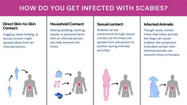 Do you have to quarantine if you have scabies?