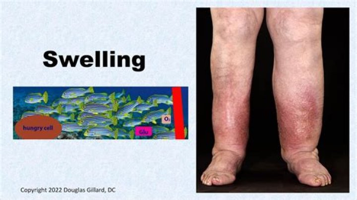 Does swelling mean its healing?