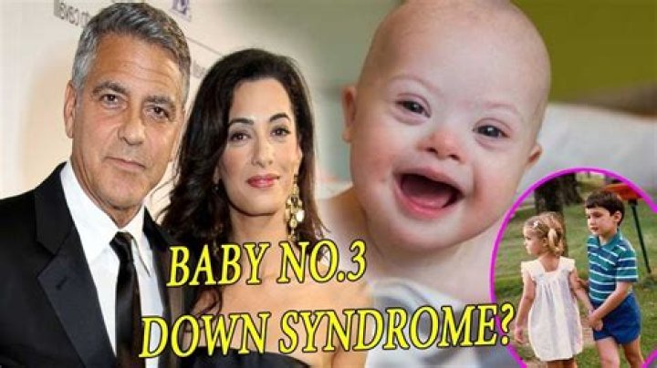 George Clooney's Son's Inspiring Journey With Down Syndrome