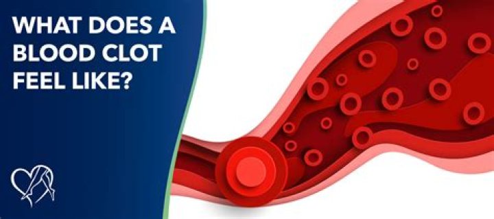How does clot feel?