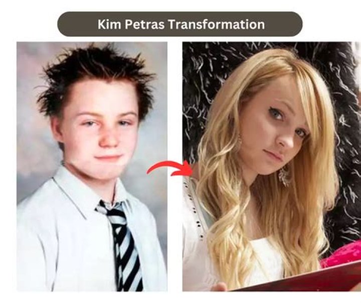 Kim Petras' Transition: Inspiration For Transformation