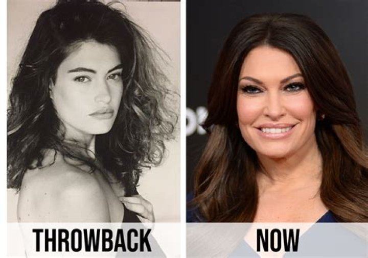 Kimberly Guilfoyle's Transformation: Explore The Before And After Images