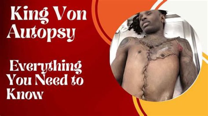 The Disturbing Truth: King Von Autopsy Photos Uncovered