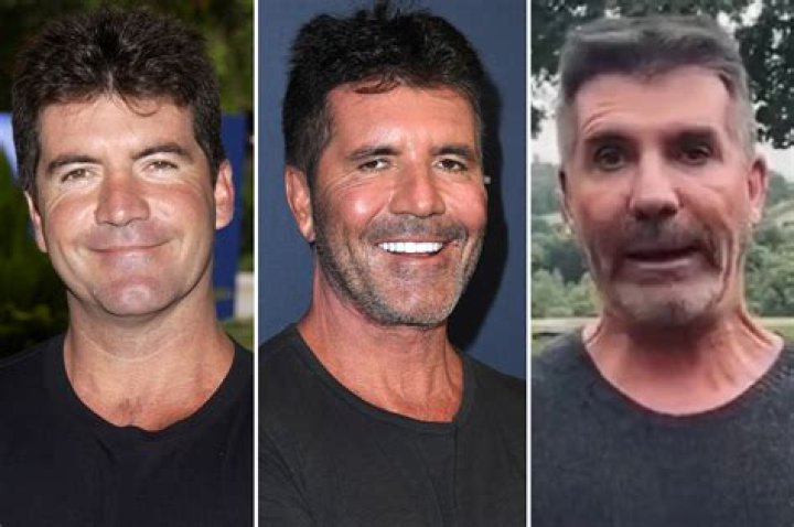 Unraveling The Mystery: What Condition Has Simon Cowell's Son Got?