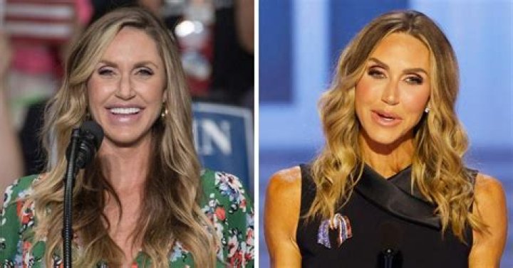 Unveiling The Transformations: Kimberly Guilfoyle's Plastic Surgeries