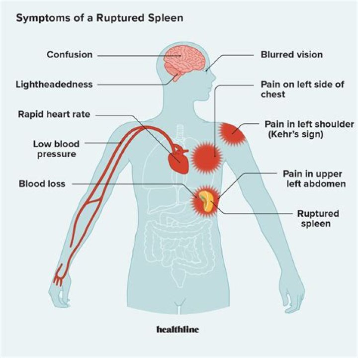 What are the symptoms of not having enough blood flow to the brain?