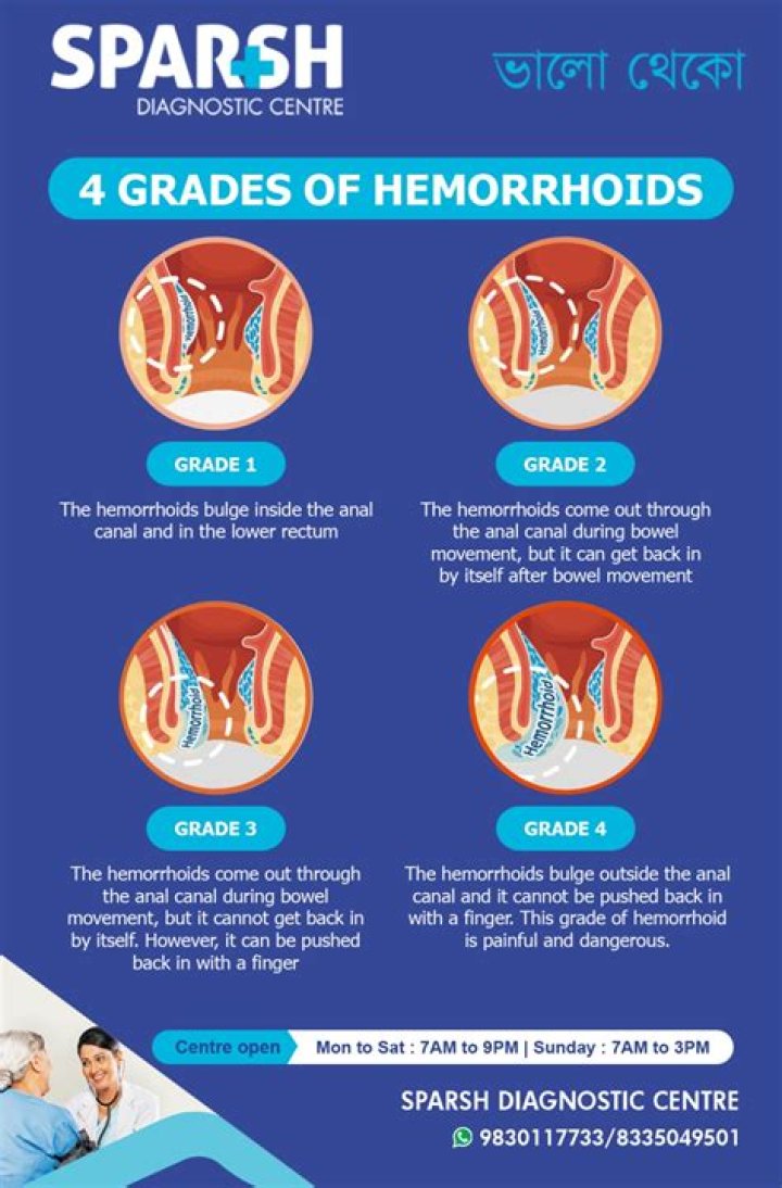 What happens if a hemorrhoid is left untreated?