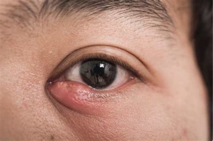 What kind of Dr do you see for tinnitus?