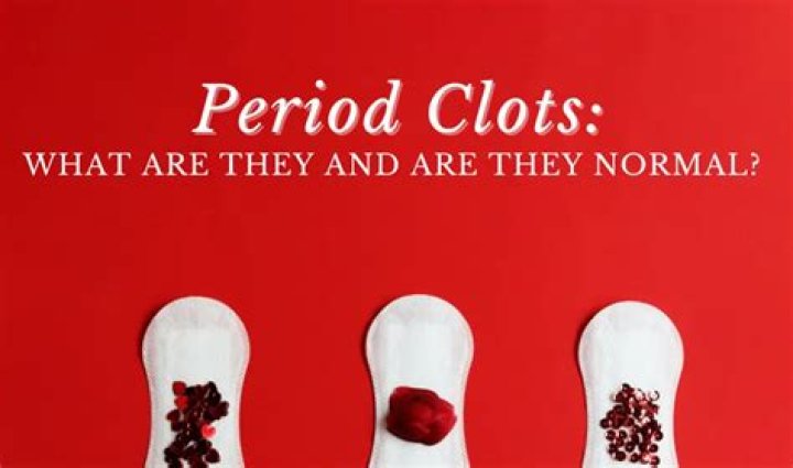 What size period clots are normal?