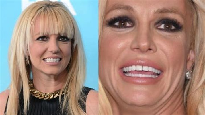 Why are my teeth separating as I get older?