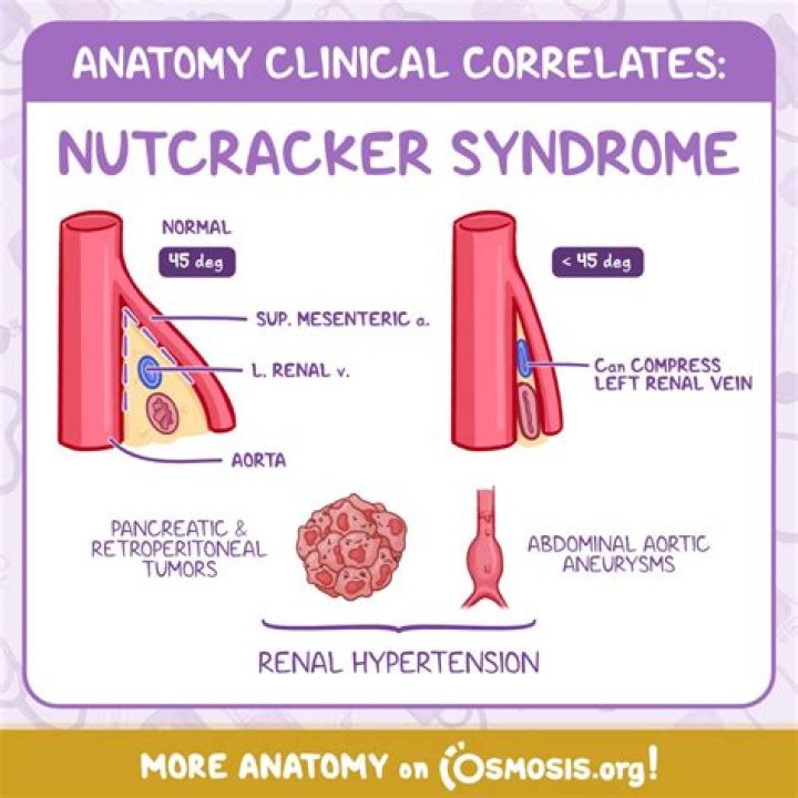 Why is it called Lima syndrome?
