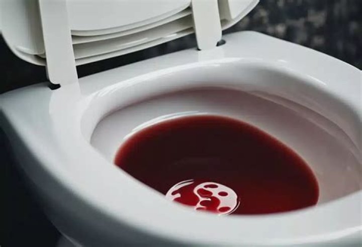 Why is my toilet water red?